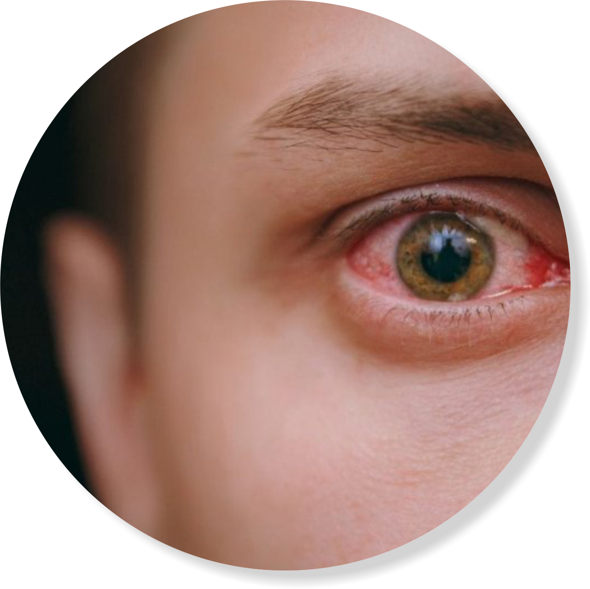 olhos.png olhos.png